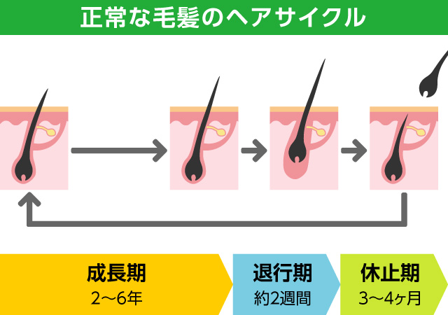 宇都宮のノアAGAクリニックが発毛のメカニズムを解説