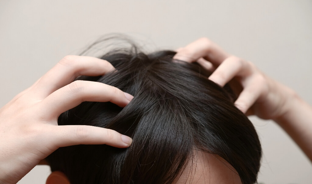 薄毛 Agaの進行パターン 栃木県で薄毛 Aga治療ならノアagaクリニック 薄毛 Agaの進行パターン 栃木県で薄毛 Aga治療ならノアagaクリニック